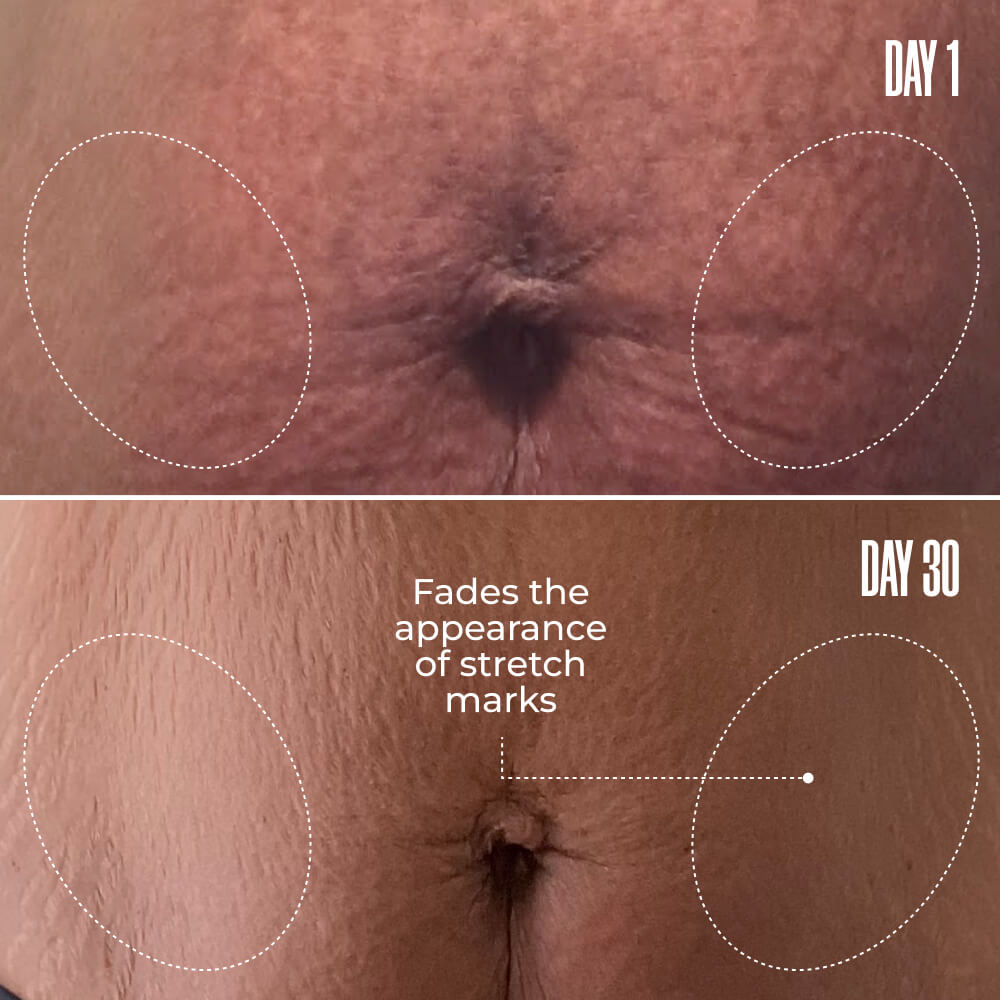 The Skin-Smoothing Duo package